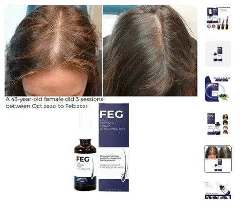GrowMist™ Hair Growth Spray – Thicker, Fuller Hair Naturally