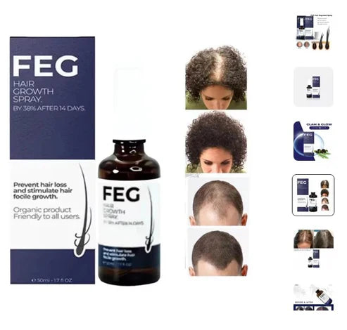 GrowMist™ Hair Growth Spray – Thicker, Fuller Hair Naturally